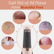 Callus Remover Rechargeable Pedicure Tool for Dead Skin